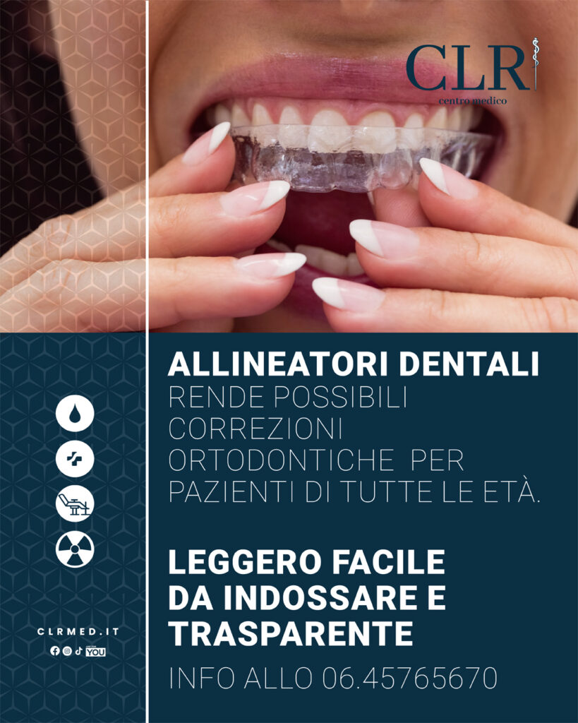 Allineatori dentali