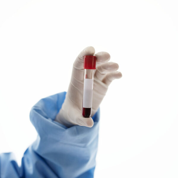 Doctor holding a blood test tube