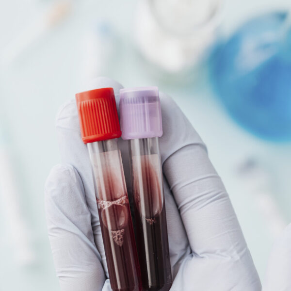 Hand of doctor holding blood test tubes during covid-19 outbreak
